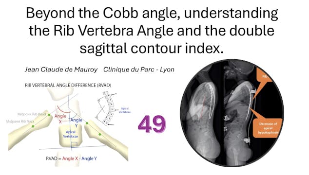 SSOL-LM Cert Tutorial 49: RVAD Case