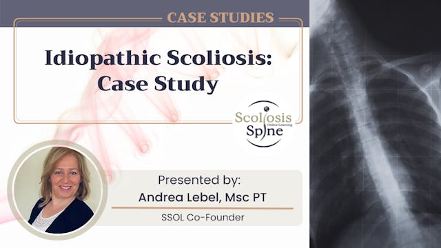 Idiopathic Scoliosis: Case Study