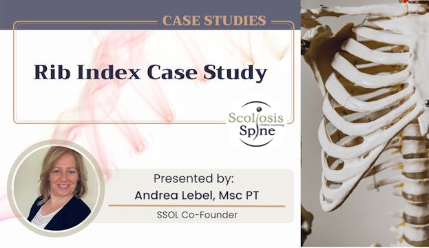 Rib Index Case Study