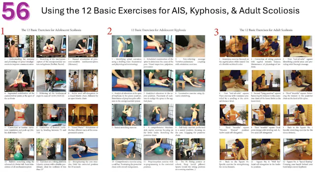 SSOL-LM Cert Tutorial 56: 12 Basic Ex's for AID, Kyphosis, Adult Scoliosis