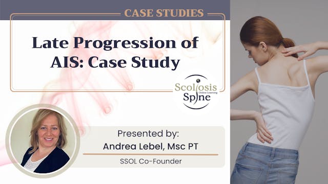 Late Progression of AIS: Case Study