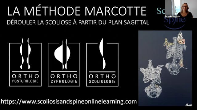 Méthode Marcotte: la scoliose et le plan sagittal