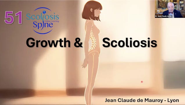 SSOL-LM Cert Tutorial 51 - Growth & Scoliosis