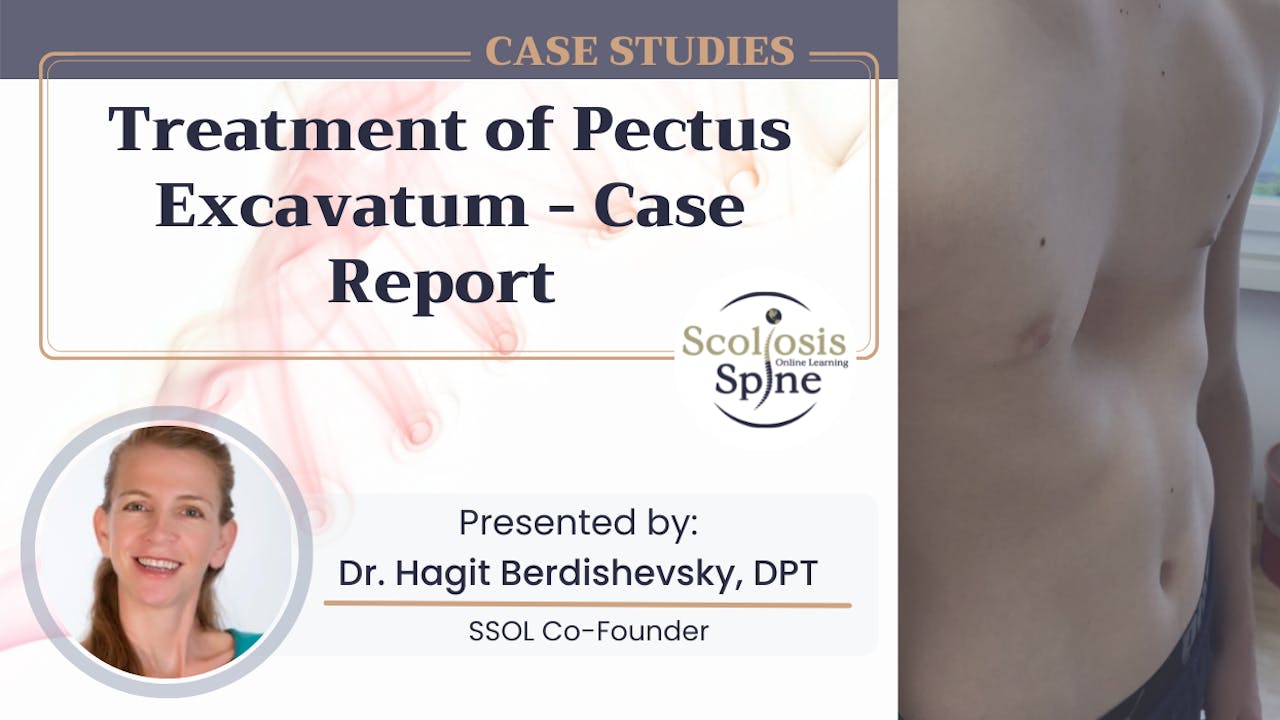 Treatment of Pectus Excavatum: Case Report
