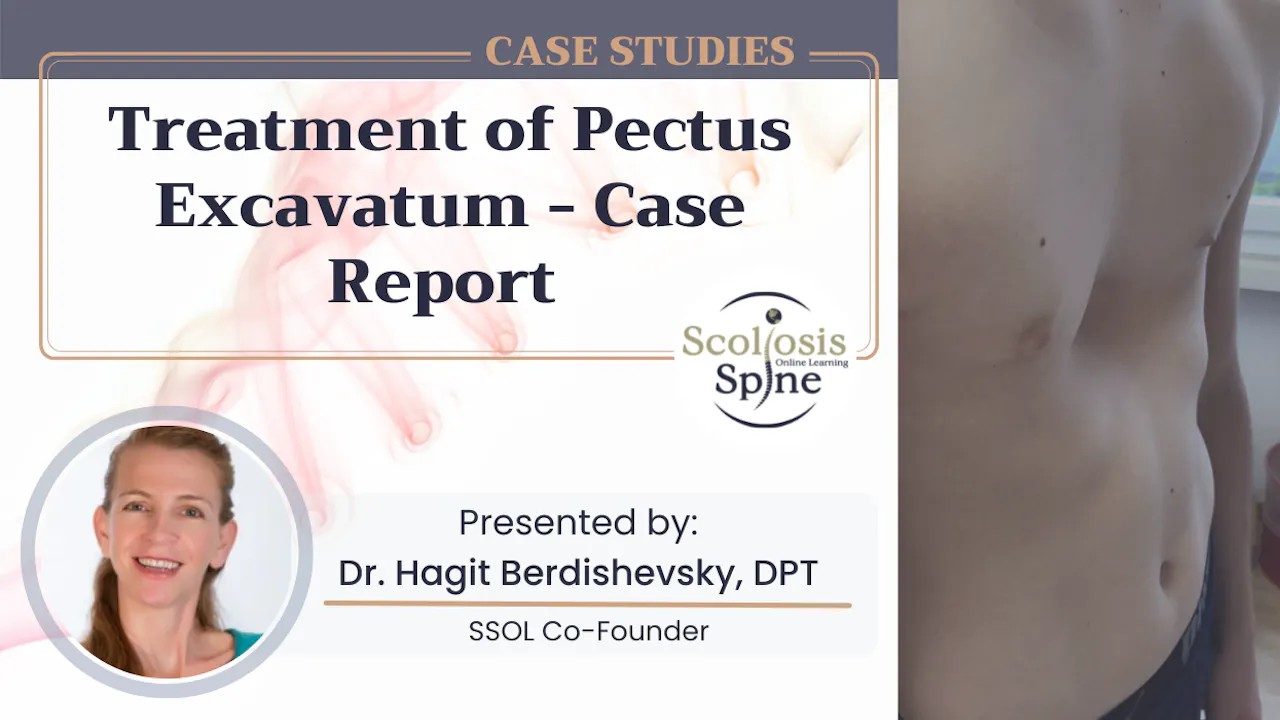 Treatment of Pectus Excavatum: Case Report - SSOL-GLOBAL