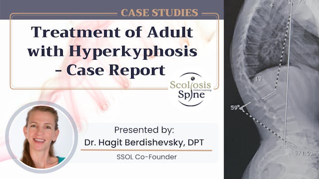Treatment of Adult with Hyperkyphosis: Case Report