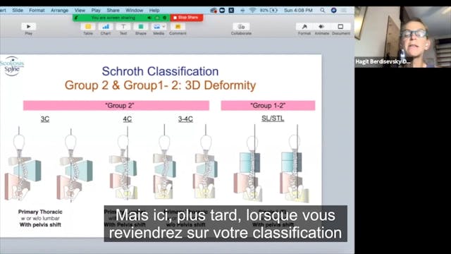 [fr] Part 7 SSOL Course Fundamentals of Scoliosis & Spinal Conditions