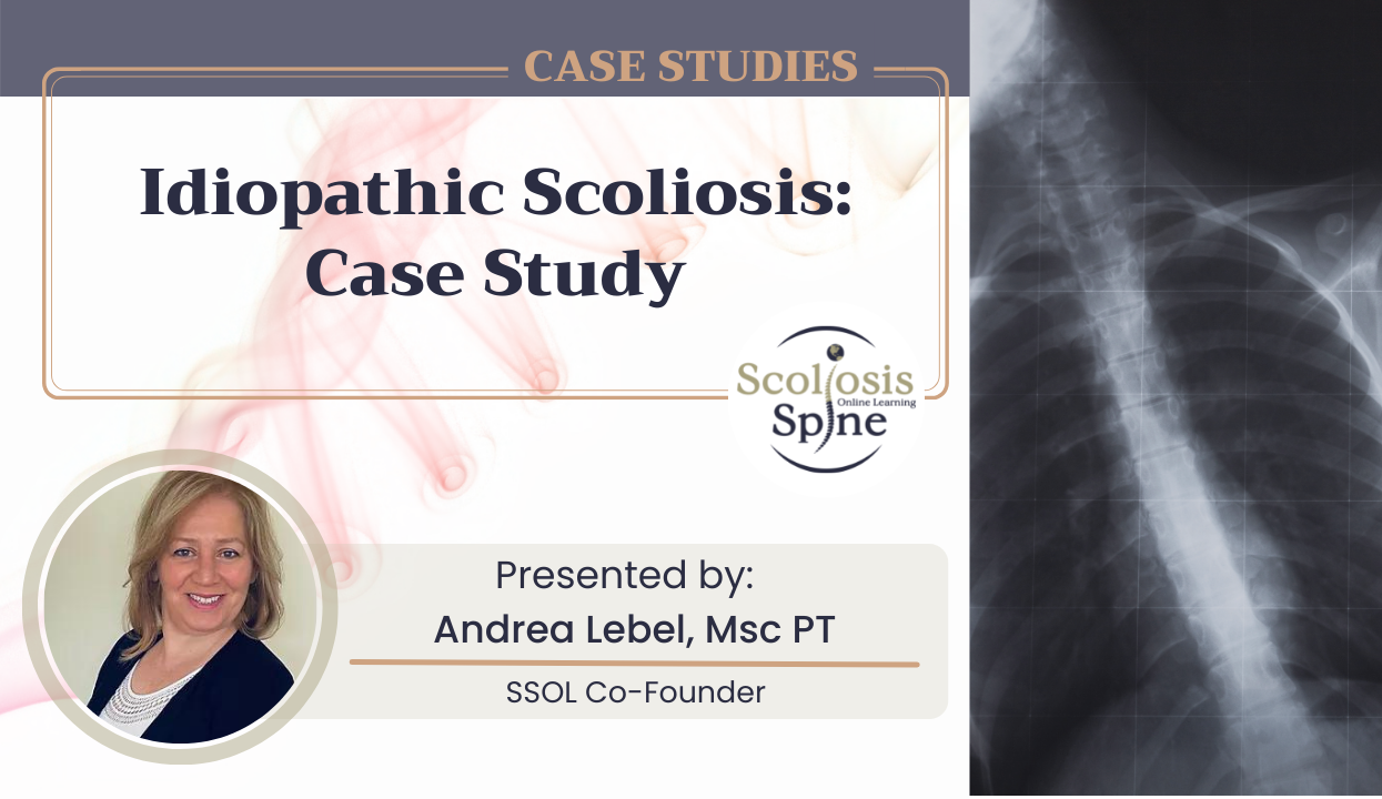 Idiopathic Scoliosis: Case Study