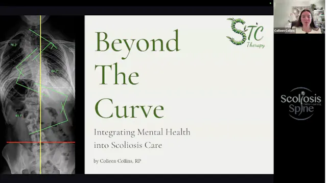 Beyond the Curve- Integrating Mental Health into Scoliosis Care by C Collins, RP