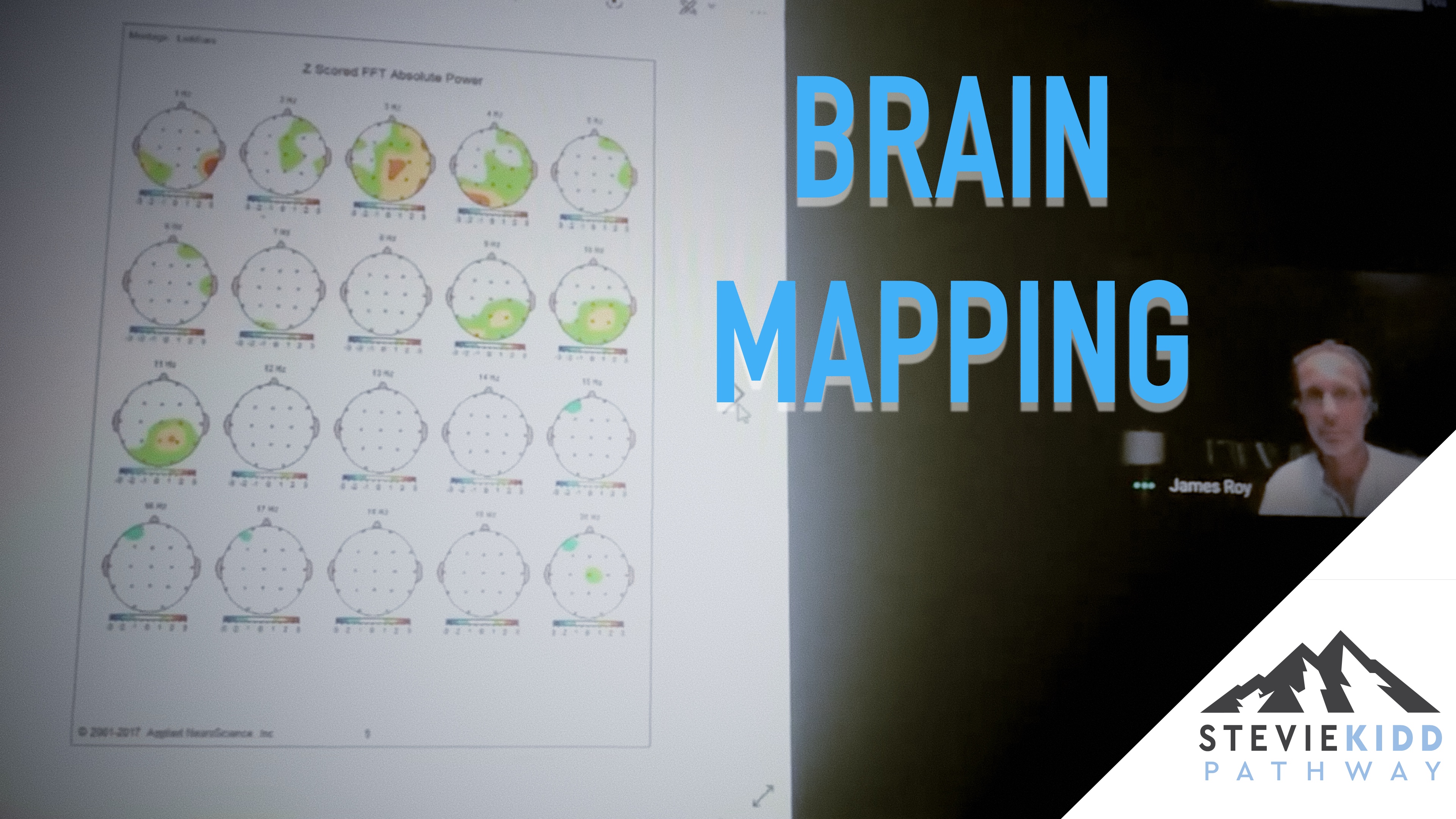 Brain Mapping Evidence - Stevie Kidd