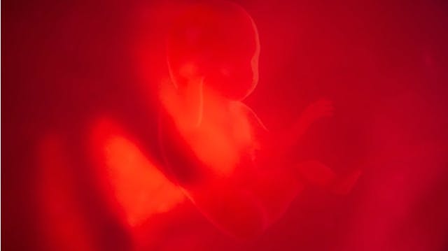 The Volcano and the Baby