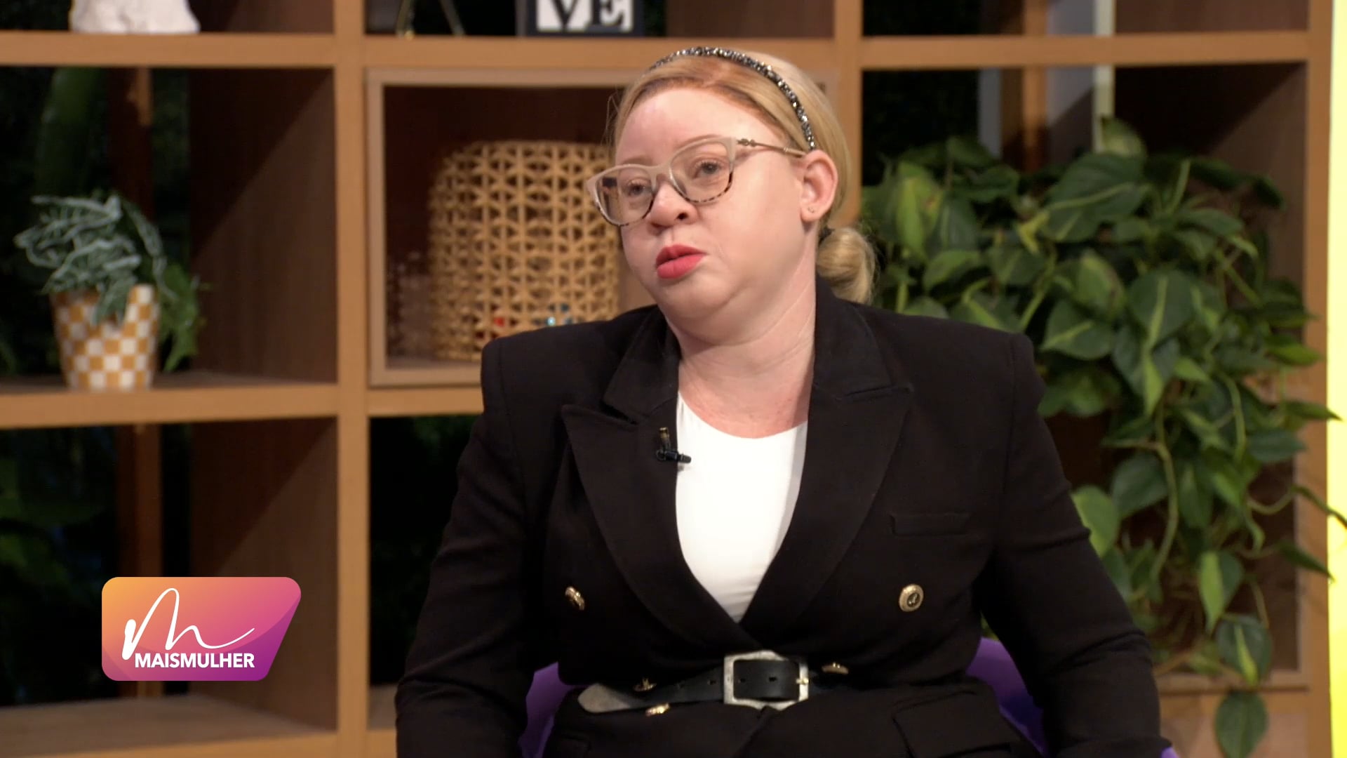 Representatividade albina na mídia