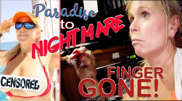 #69 UNCENSORED Paradise To Nightmare (Finger Gone!) - Season 2