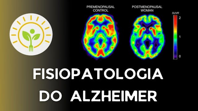 Fisiopatologia da doença de Alzheimer