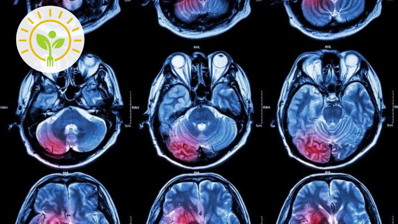 Inflamação e demência