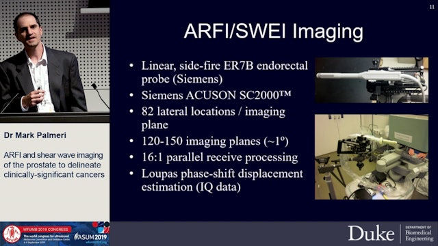 ARFI and shear wave imaging of the prostate