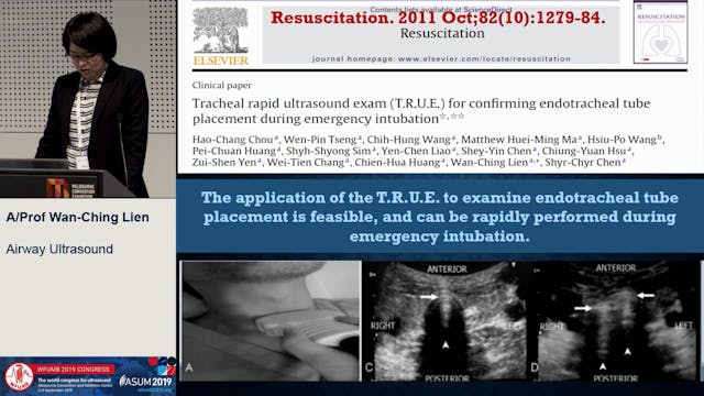 Airway ultrasound