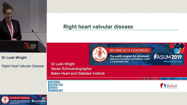 Right heart valvular disease