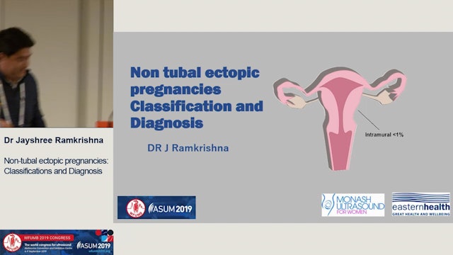 Non-tubal ectopic pregnancies Classification and Diagnosis