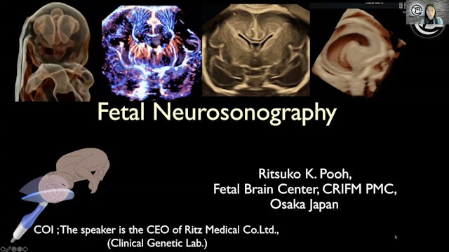 Fetal Neurosonography