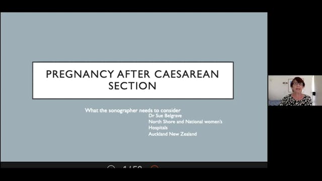 Pregnancy after Caesarean Section