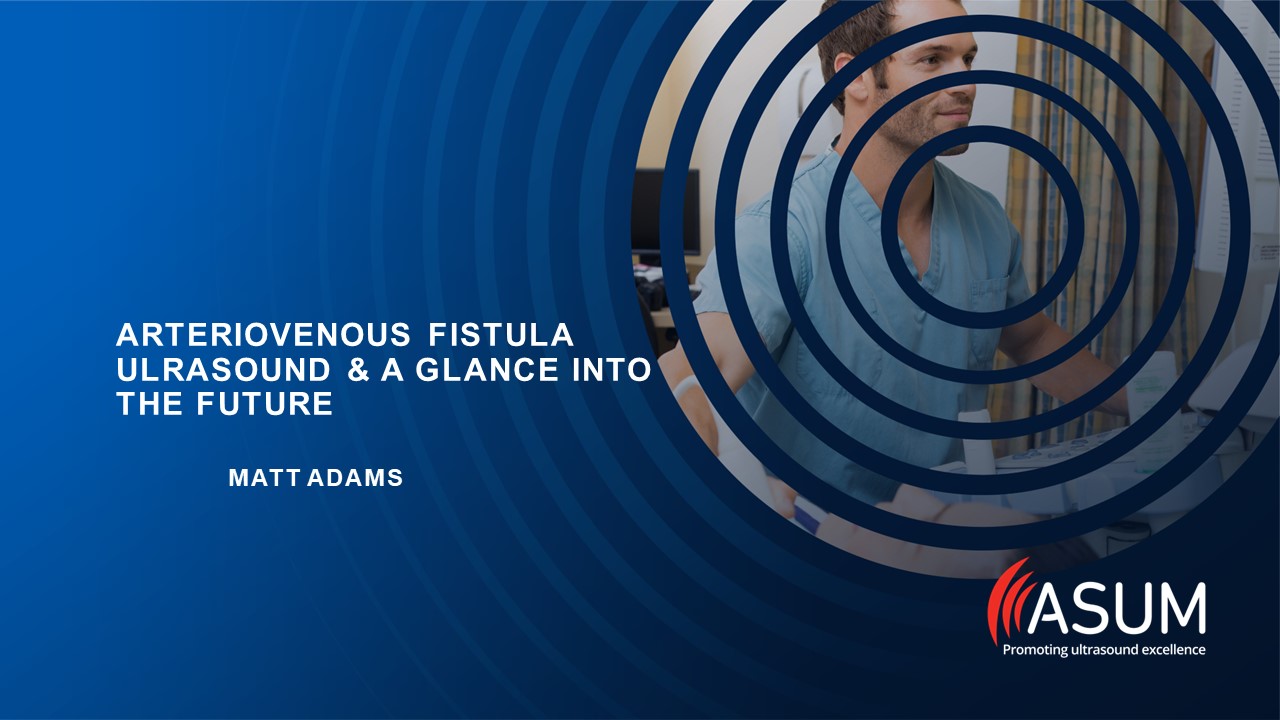 Arteriovenous Fistula US & a Glance into the Future