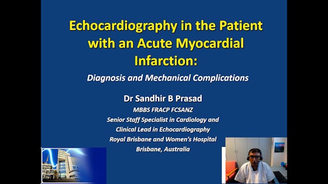 Echocardiography in the Patient with ...