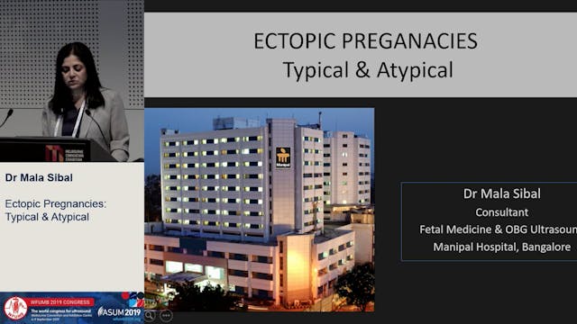 Ectopic: typical and atypical