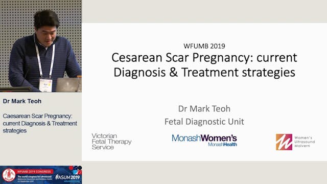 Diagnosis and management of caesarean...