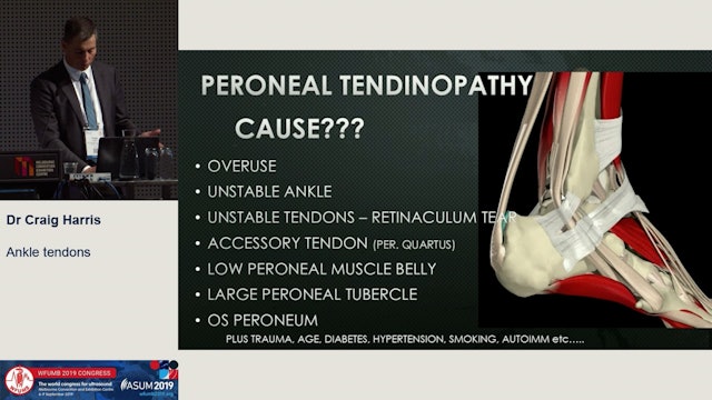 Ankle tendons
