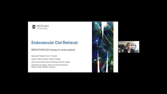 Endovascular Clot Retrieval