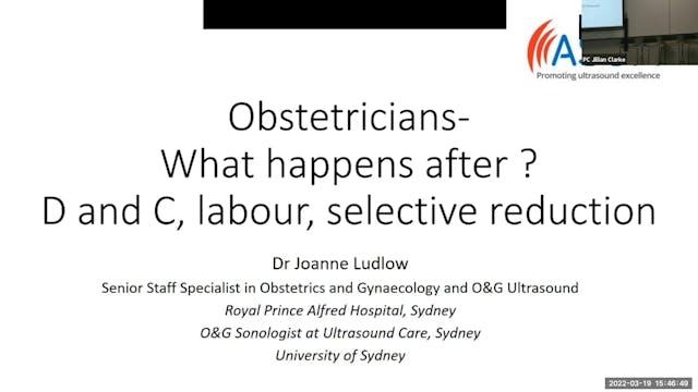 Obstetricians- What happens after D and C, labour, selective reduction