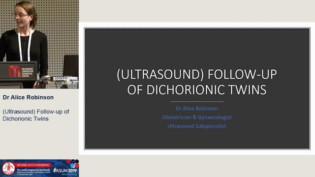 Follow-up of dichorionic twins