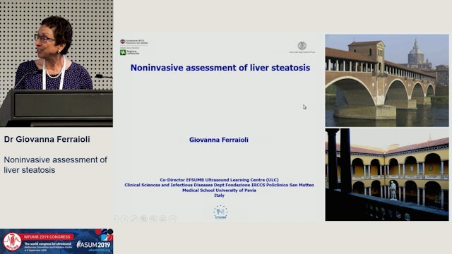 Non-invasive assessment of liver steatosis