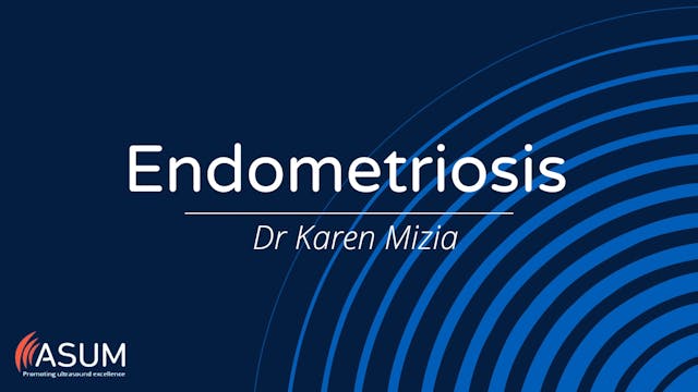 Endometriosis - A case report