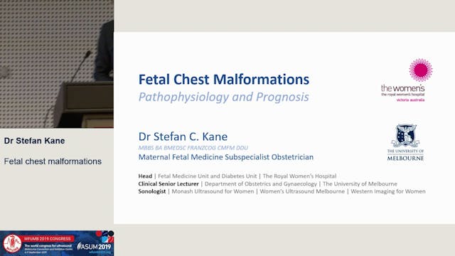 Fetal chest malformations