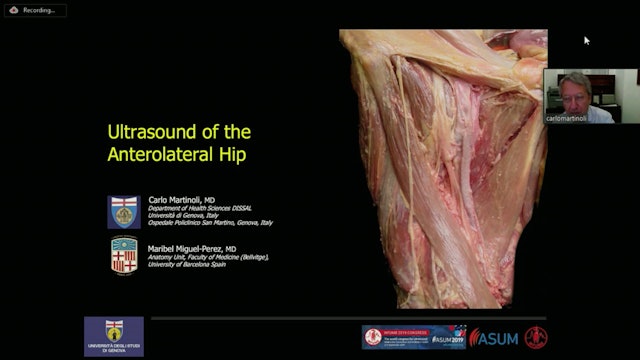 Ultrasound of the anterolateral hip