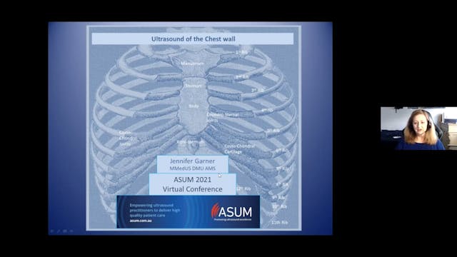 Ultrasound of the chest wall