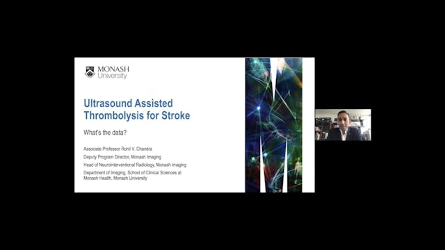 Ultrasound Assisted Thrombolysis for ...