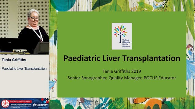 Liver transplant US; how and when?