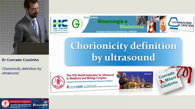 Chorionicity definition by ultrasound