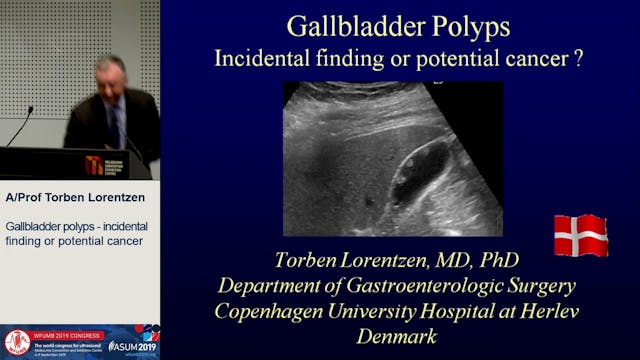 Gallbladder polyps - incidental findi...