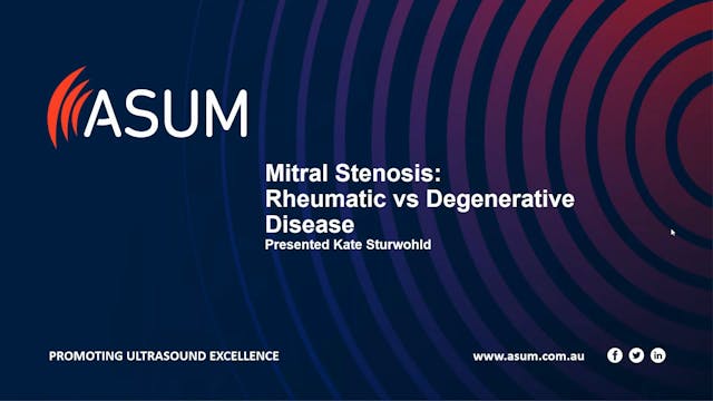 Mitral Stenosis Rheumatic vs Degenera...