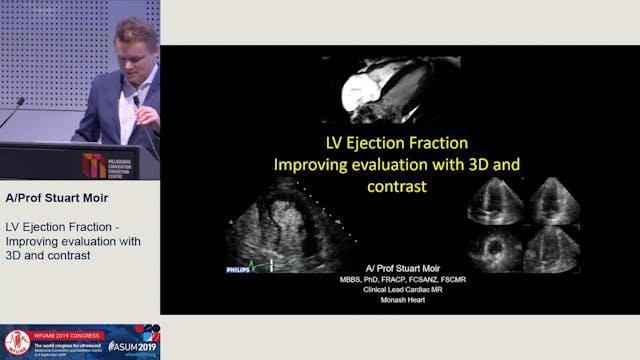 Improving LVEF assessment - Contrast ...