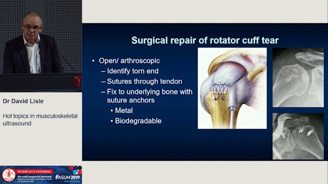 Hot topics in musculoskeletal ultrasound