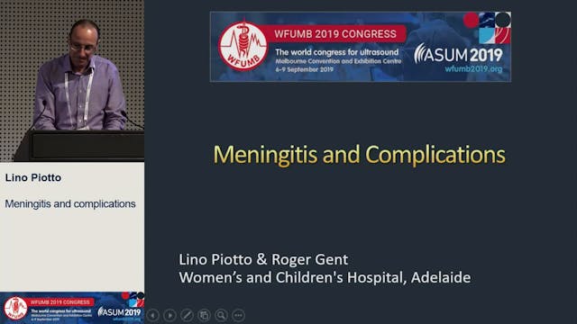 Meningitis and complications