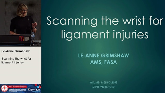 Scanning the wrist for ligament injuries