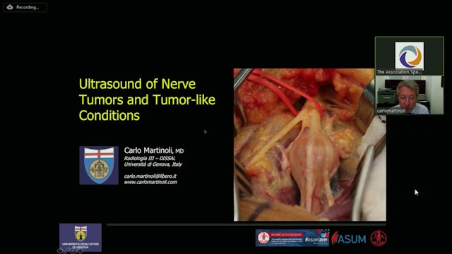 Ultrasound of Nerve Tumors and Tumor-like Conditions