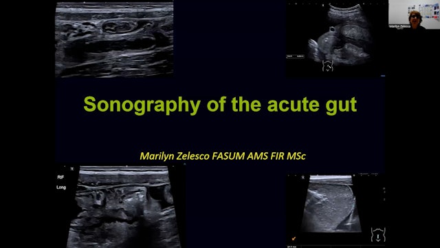 Sonography of the Acute Gut