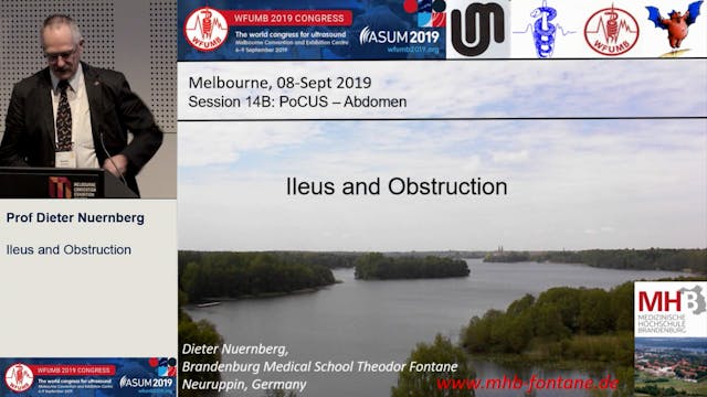 Ileus and obstruction